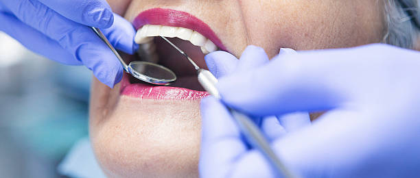 Best Emergency Treatment for Oral Infections in Santee, SC